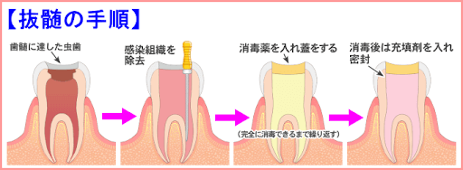 ̎菇