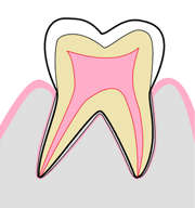 健康な歯の断面